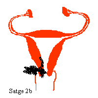 Stage 2b